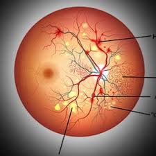Diabetic eye checkup